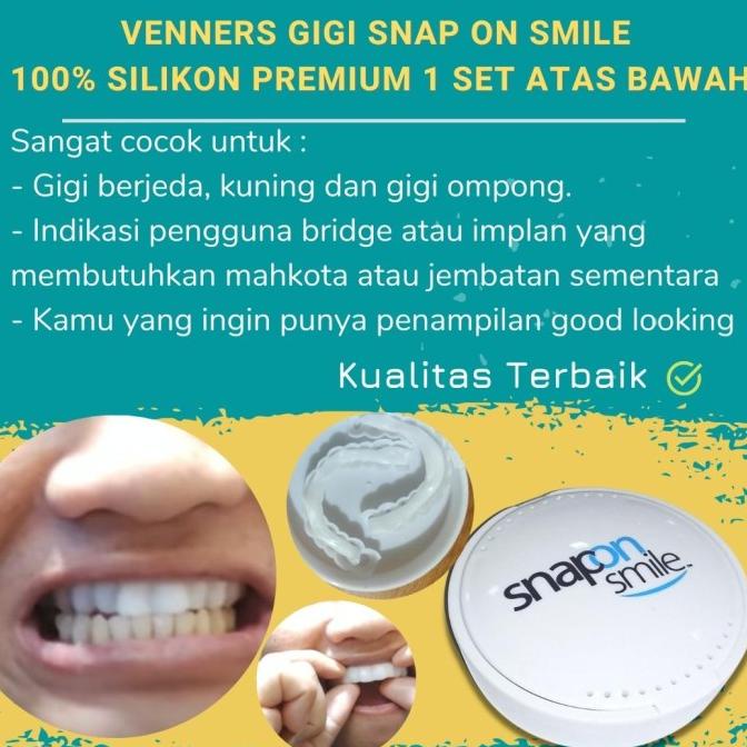 Veneer Snap On Smile Gigi Palsu Silikon Berkualitas 1 Set Pelapis gigi