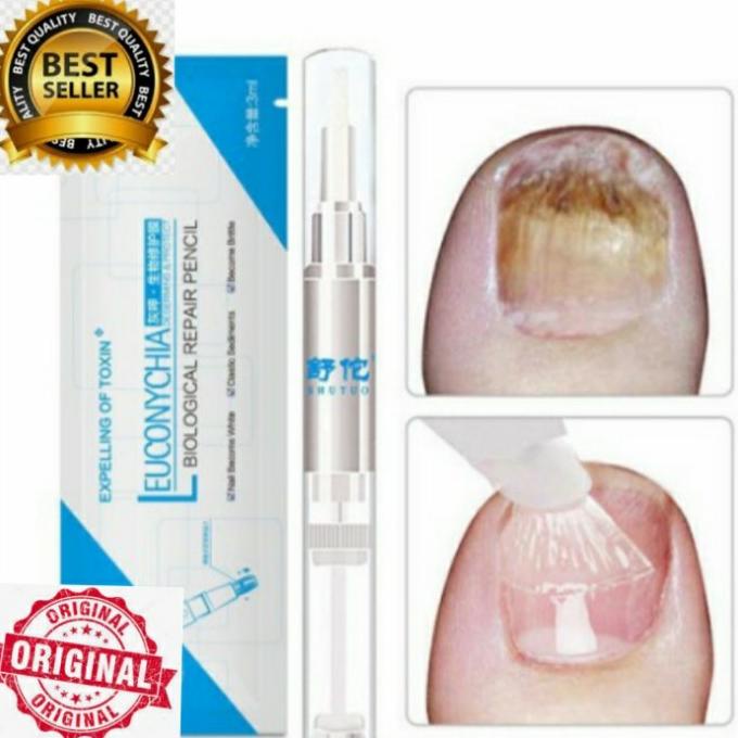 Big Sale Salep Jamur Kuku Ampuh | Obat Perawatan Jamur Kuku Jari Tangan Kaki Big Sale