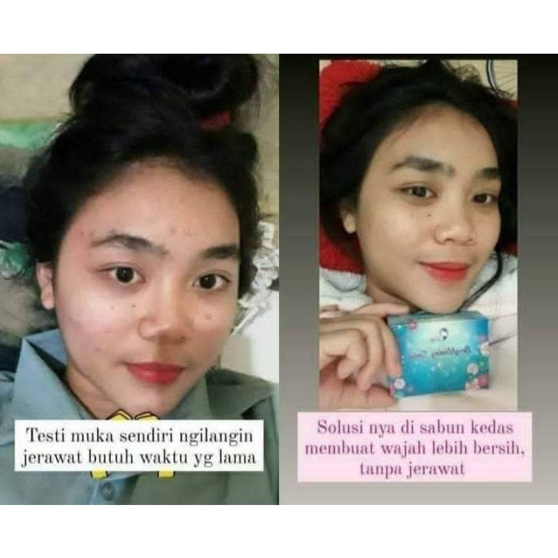 KEDAS BEAUTY sabun brightening soap sabun multifungsi