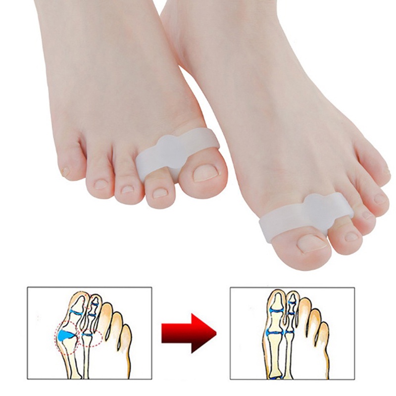 2pcs Silikon Pemisah Jari Kaki Hallux Valgus