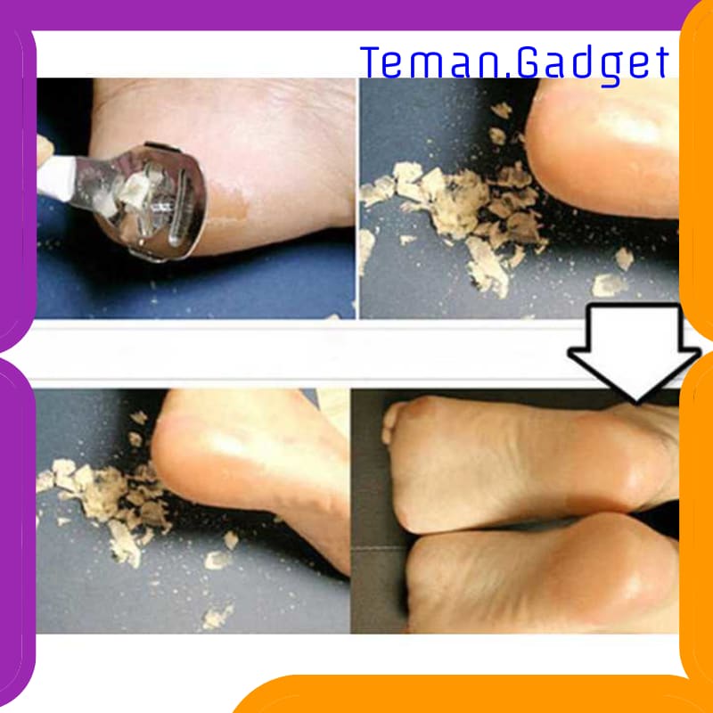 TG-FE168 ALAT PERAWATAN KAKI PEDICURE FOOT CARE