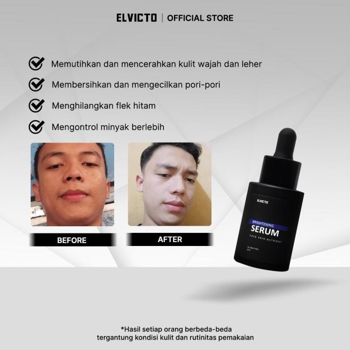 ELVICTO BRIGHTENING SERUM