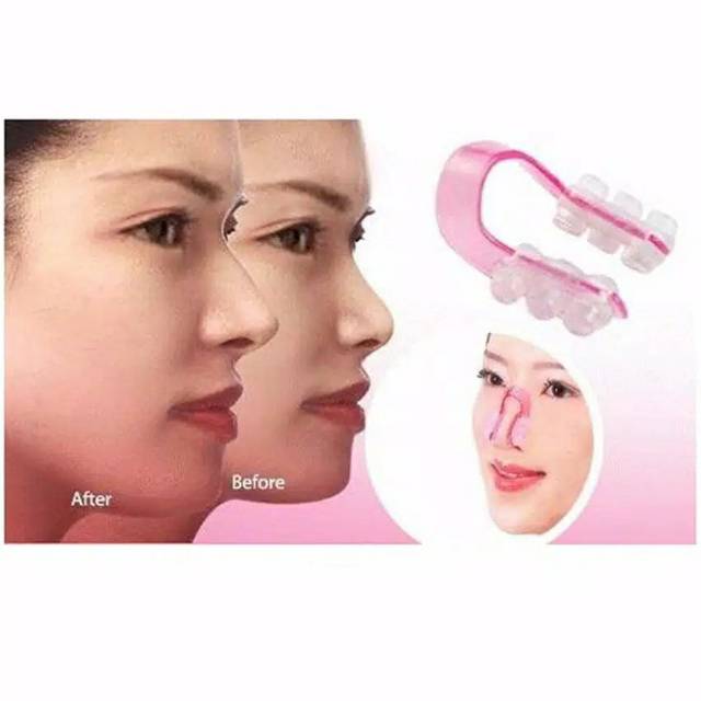 Alat Pemancung Hidung - Solusi Hidung Mancung