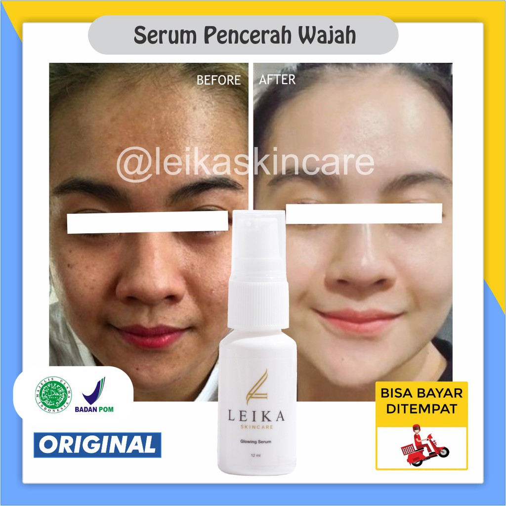 Serum Glowing Serum Pencerah Wajah Ampuh Mencerahkan Wajah Kusam 100% ORIGINAL BPOM Perawatan Kecant