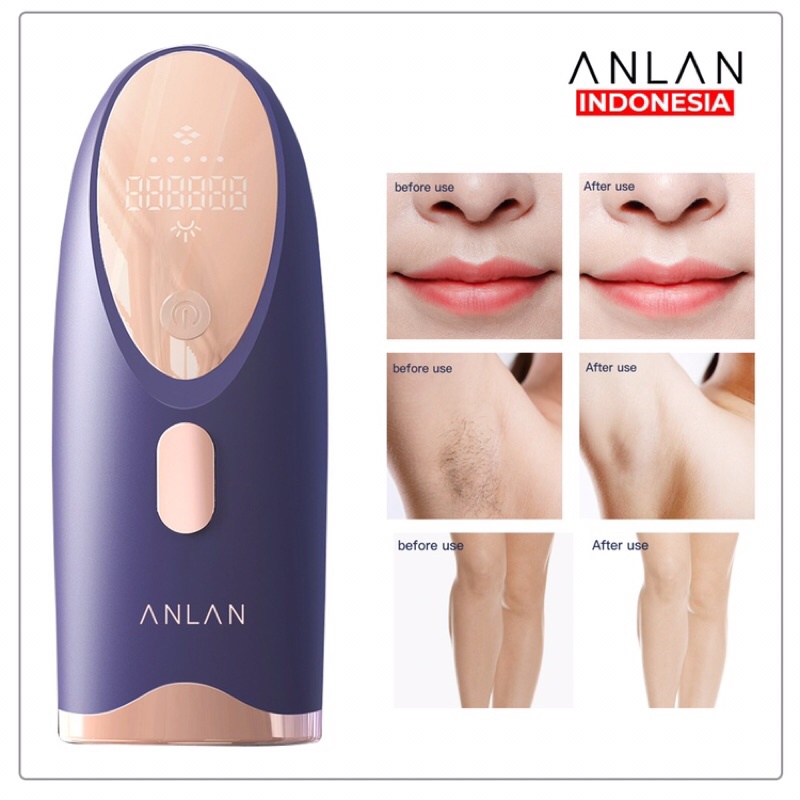 ANLAN Penghilang Bulu Permanen / IPL Hair Removal