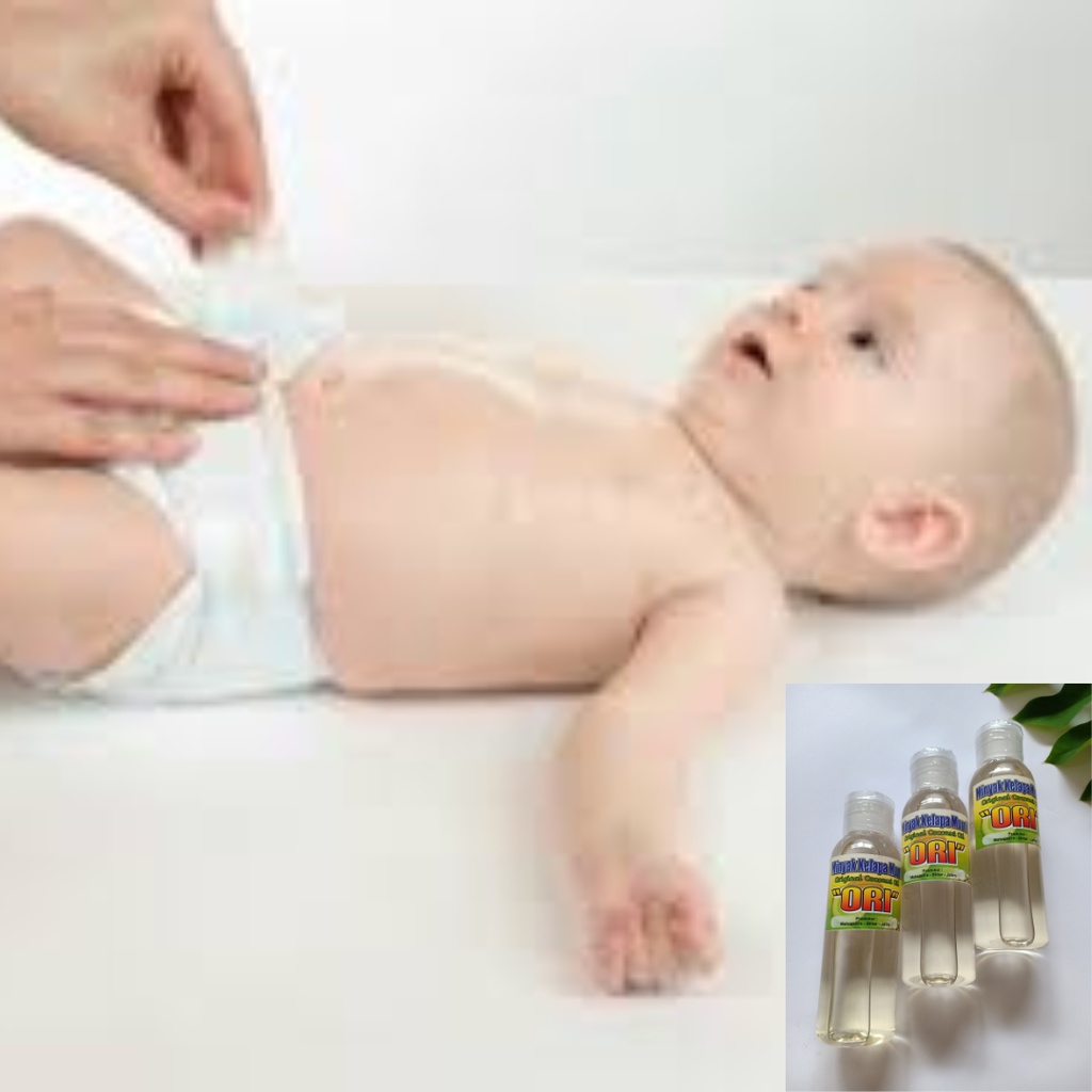(FREE GOLD)MINYAK KELAPA ASLI MURNI OBAT RUAM POPOK AMPUH UNTUK BAYI/MANULA OBAT RUAM PIPI BAYI OBAT