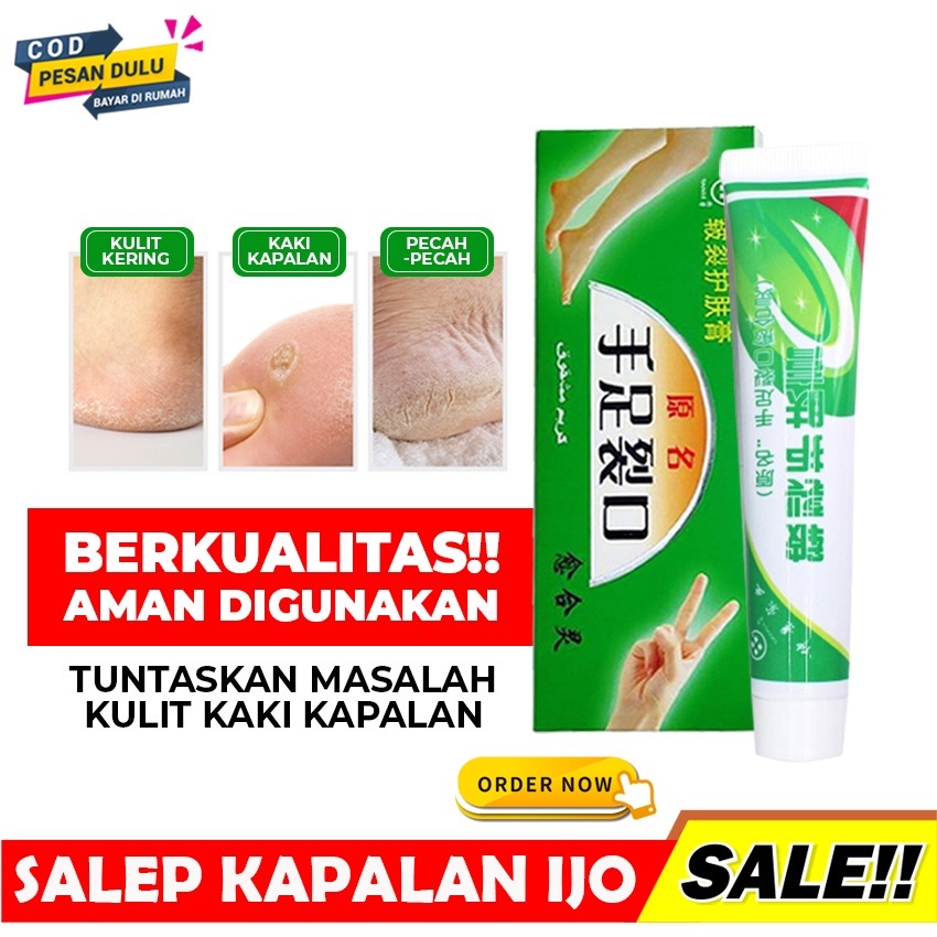 HOPE STORE - AMPUH !!!  SALEP TUMIT PECAH - PECAH / KERING TUMIT SIKU DAN TELAPAK TANGAN