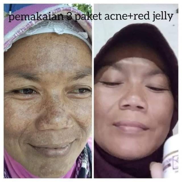 Cream RK Glow BPOM Premium