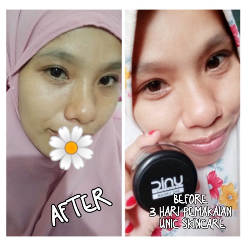 Unic Skincare/Cream BPOM/ Penghilang Flek/ Krim Wajah