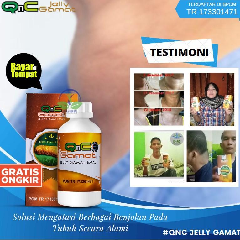 [COD] OBAT KISTA DERMOID - KISTA ATEROMA - KISTA GANGLION - OBAT KISTA ALAMI & AMAN QNC ORIGINAL