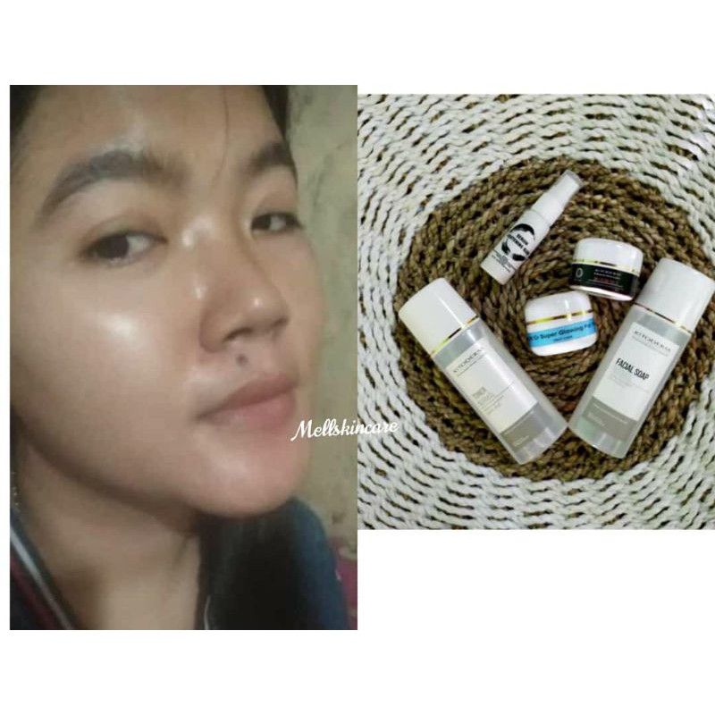 PAKET SUPER GLOWING KITODERM FARMASI
