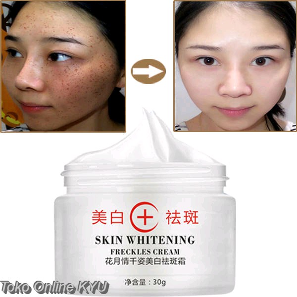 Cream HYQING Pemutih dan Penghilang Flek Hitam
