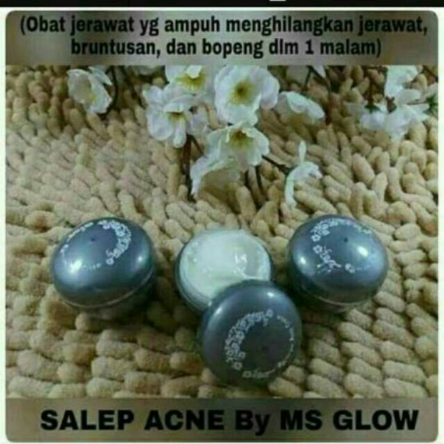 Salep Acne Ms Glow Original