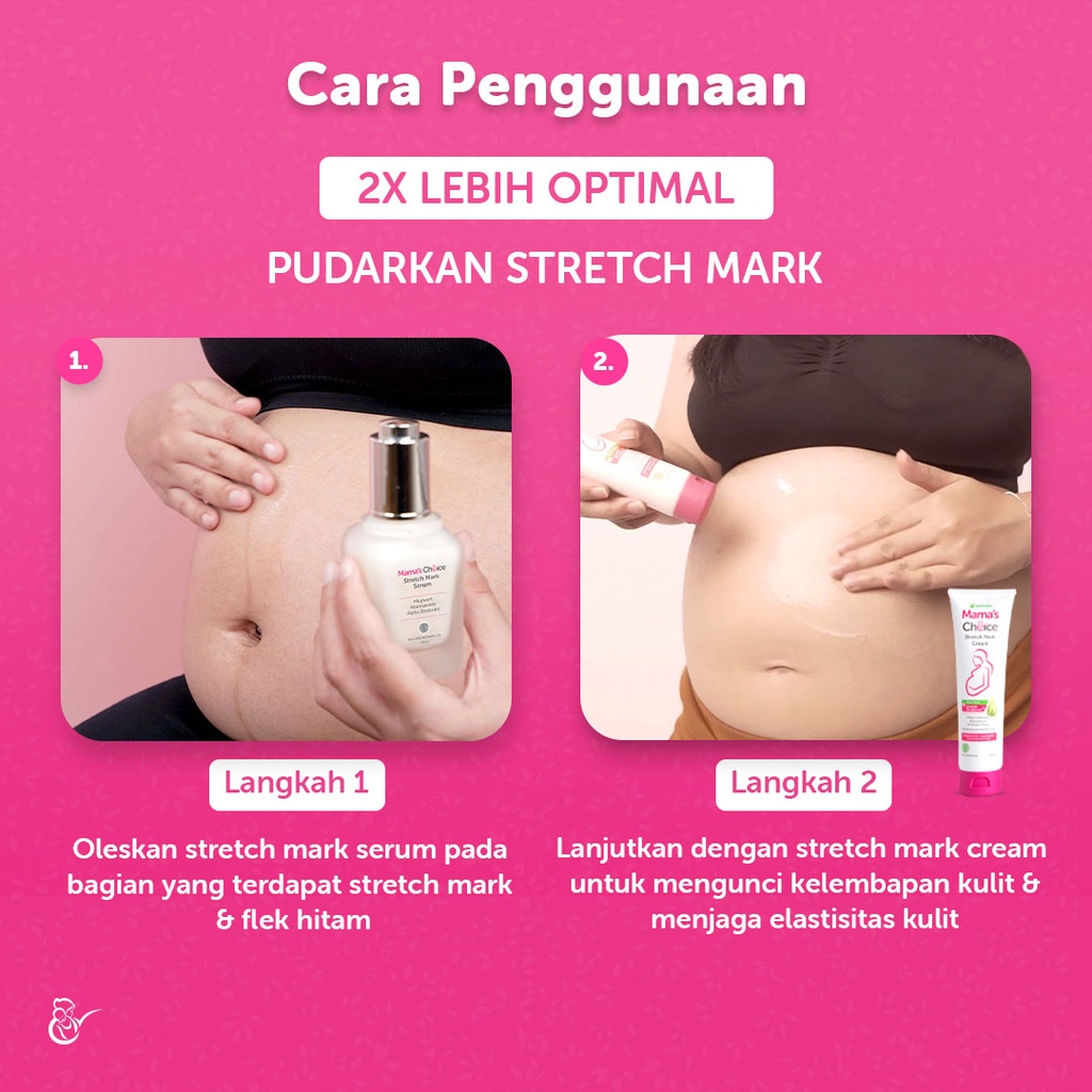 Stretch Mark Treatment Series Mama's Choice (Stretch Mark Cream + Serum)