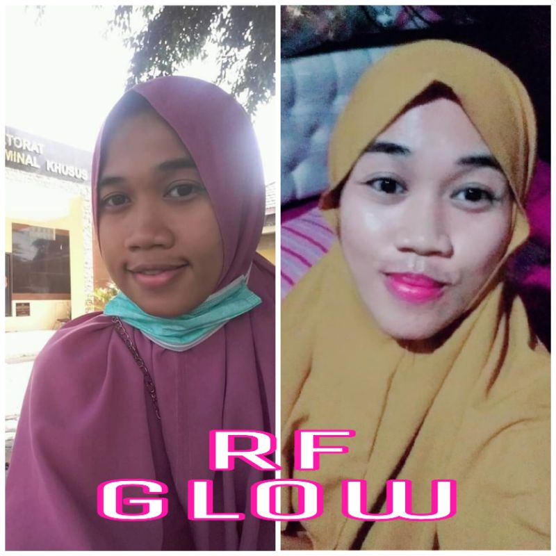 cream 2 in 1 RF Glow