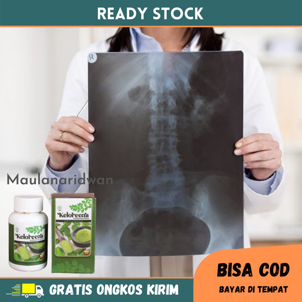 Obat Sakit Pinggang, Sakit Pinggang Sebelah Kanan / Kiri, Nyeri Sendi, Nyeri Otot Punggung, Obat Nye