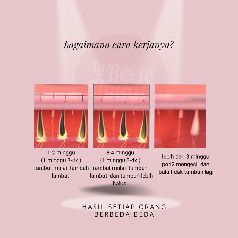 IPL Laser Hair Removal Perontok Bulu Permanent Alat penghilang bulu Tanpa SAKIT bergaransi Flash 990000