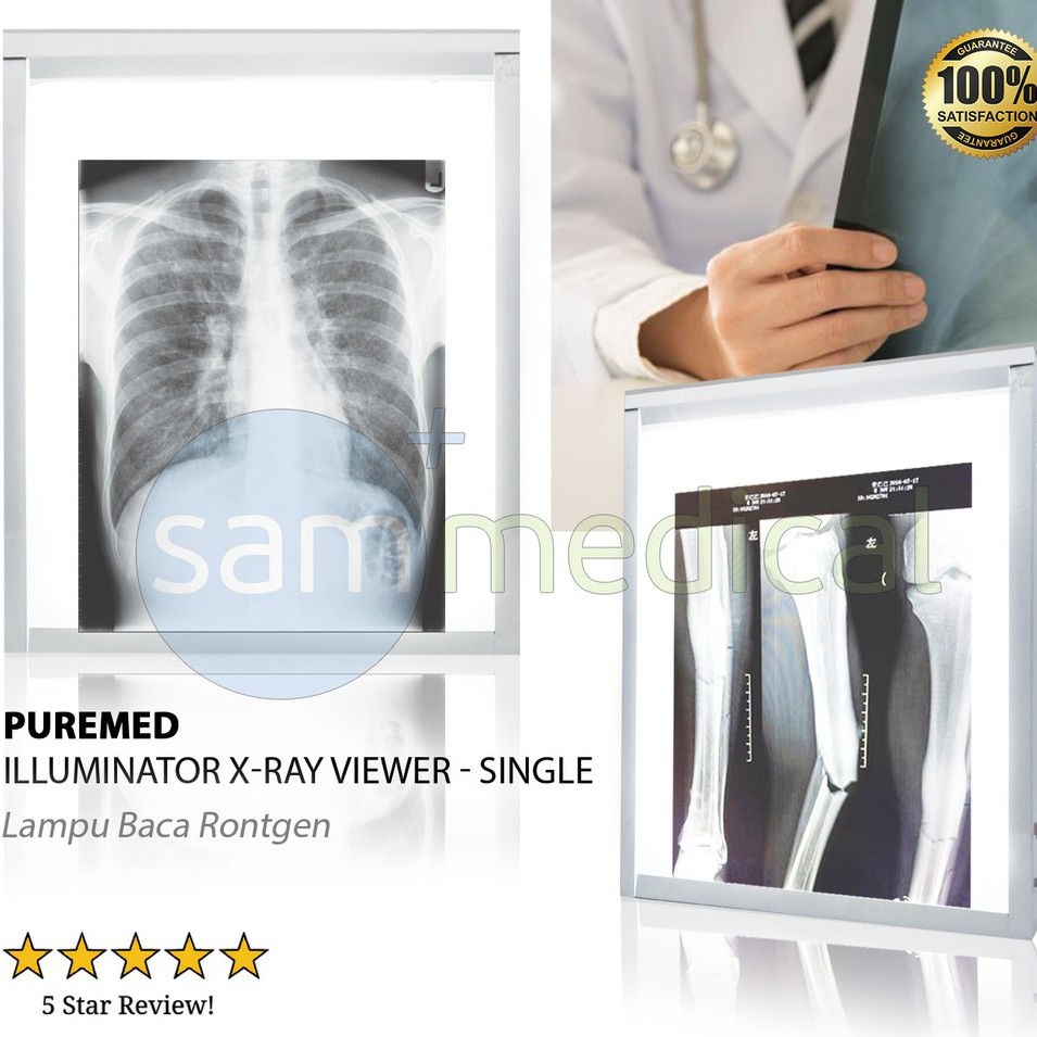 Illuminator X-Ray Viewer / Lampu Baca Rontgen