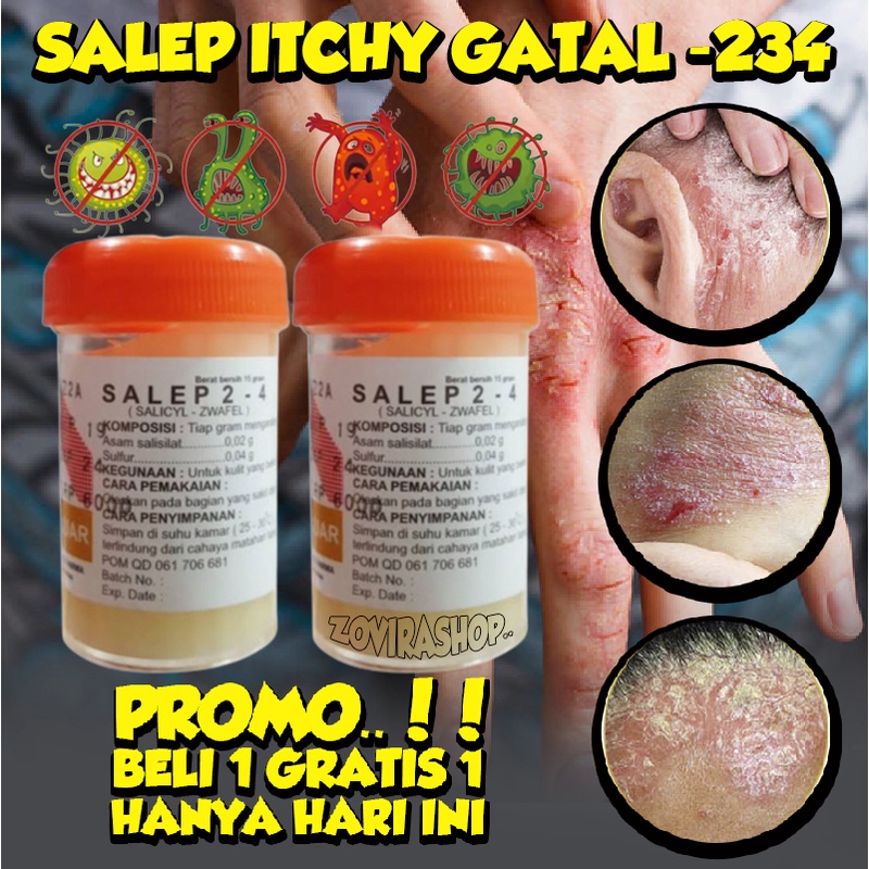 SALEP ITCHY 234 Atasi Semua Gatal Pada Kulit Kudis Panu, Kurap, Kutu Air, dll