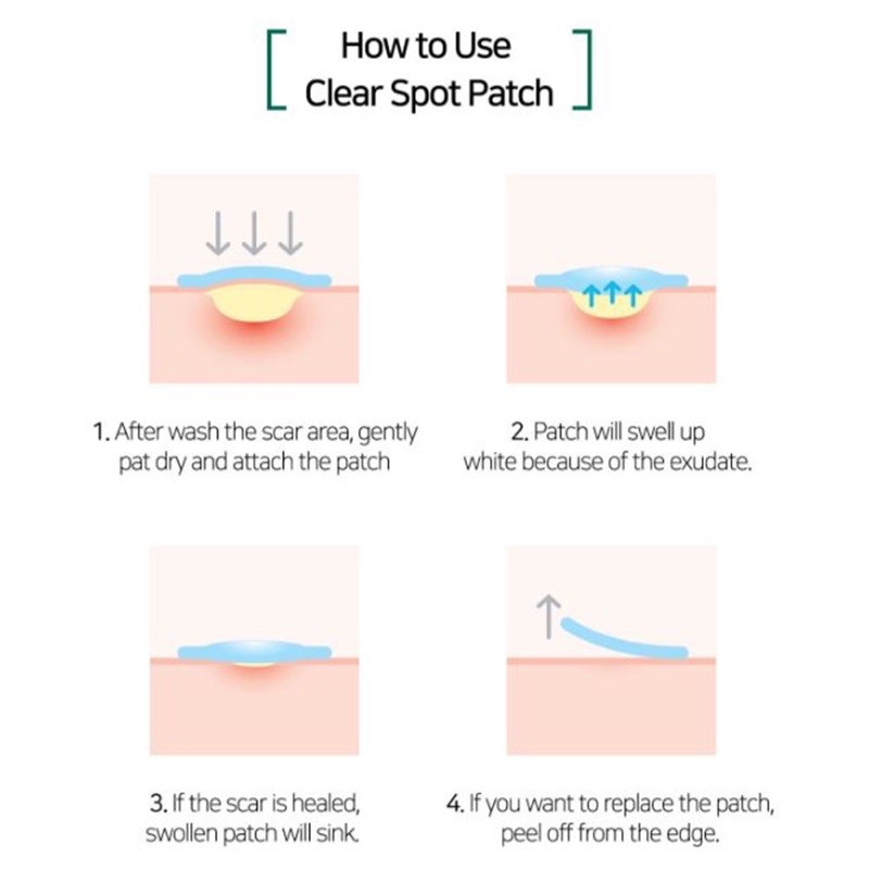 Image of SOME BY MI Acne Clear Spot Patch Jerawat #4