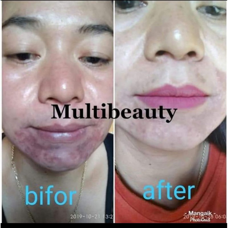 Multy Beauty Soap MBS