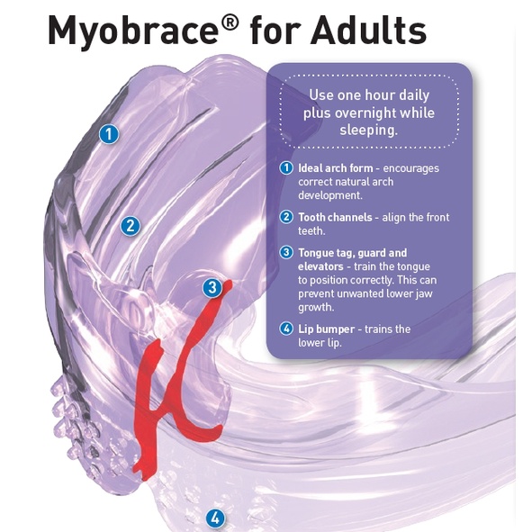MYOBRACE for ADULT (DEWASA) 15+/ MYOFUCTIONAL ORTHODONTICS/ TRAINER GIGI ORIGINAL/ TRAINER ALIGNMENT