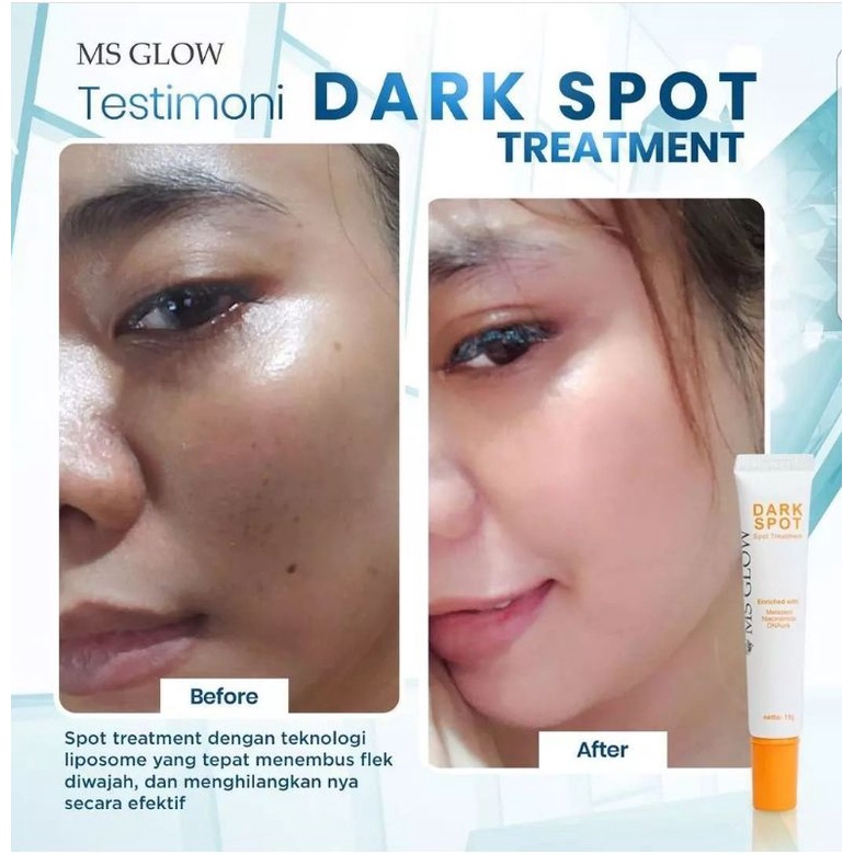 Paket perfect Flek Paket Ultimate + Serum Gold + Dark Spot MS GLOW