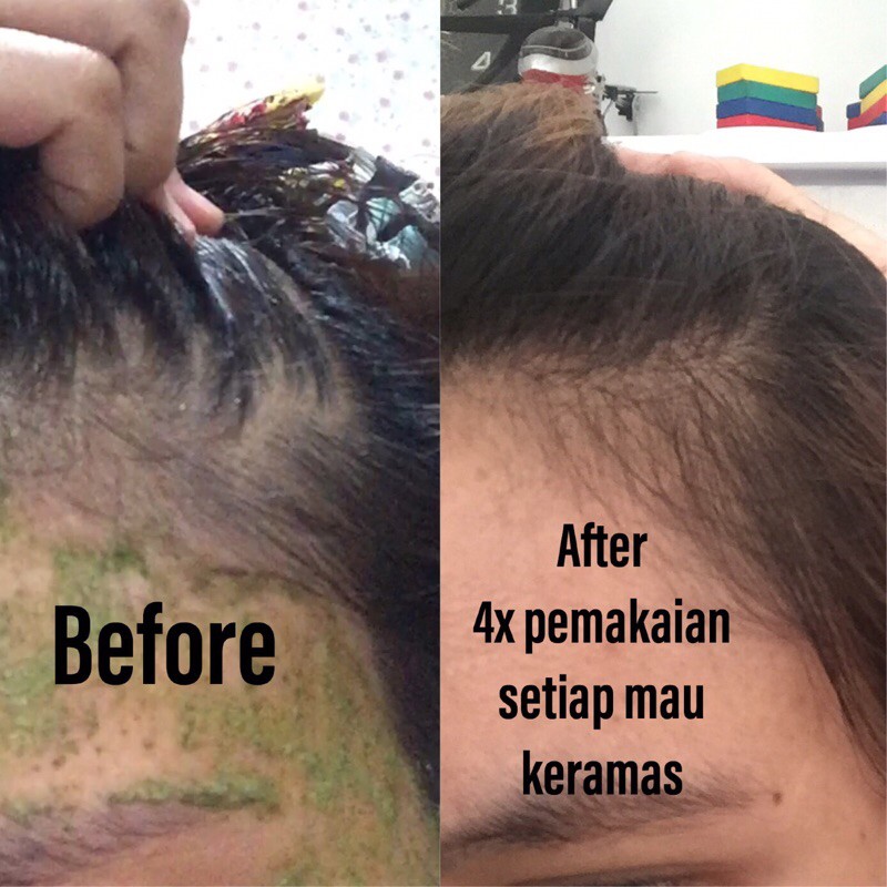 NAVENS Minyak kemiri ASLI murni 100% haircare Serum penumbuh rambut rontok dan botak minyak kemiri bakar dewasa bayi dan anak by naturahavens-2