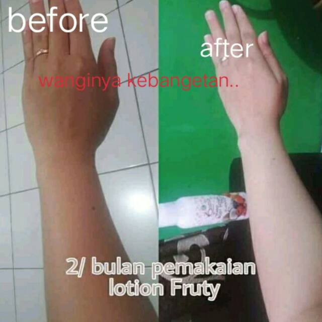 batrisyia herbal skincare hand body lotion fruity 100ml , 250ml pencerah badan,pelembab, aman herbal halal bpom batrisya batrisia batris batrisiya