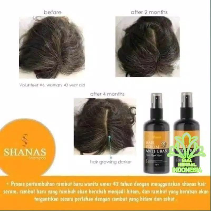 COD FREE ONGKIR Terlaris Serum Penghilang Uban Shampo Anti uban shanas ampuh