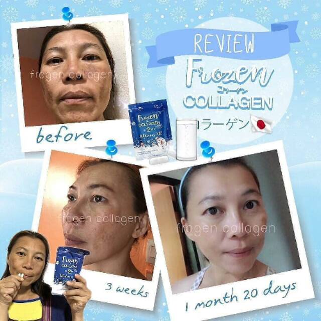 Frozen collagen