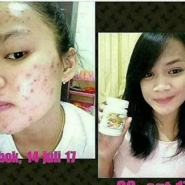 Frutablend kapsul ajaib hwi
