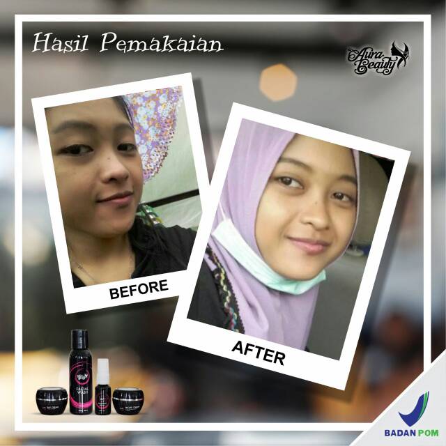 CREAM TERLARIS no. 1 di SHOPEE aurabeauty pemutih wajah booming glowing  aman halal BPOM