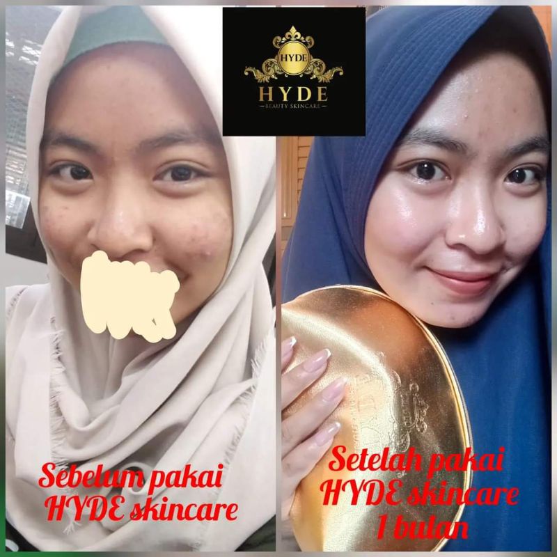 Hyde beauty skincare Facial Wash | Serum lemon | Night Cream | Day Cream