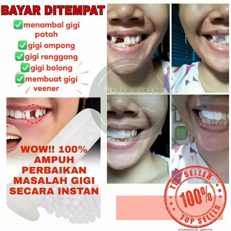 Penambal Gigi Ompong/Temptooth/Penambal Gigi Patah Instan / Gigi Palsu Instan /Diy Tooth
