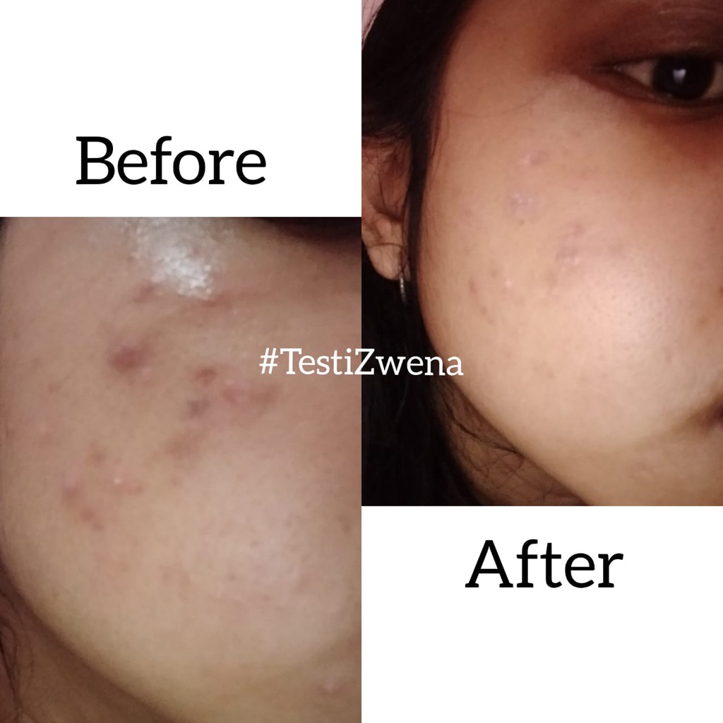 ZWENA Brightening Day Cream with Rosa damascena Flower Skincare Pencerah dan Nutrisi Wajah Original BPOM