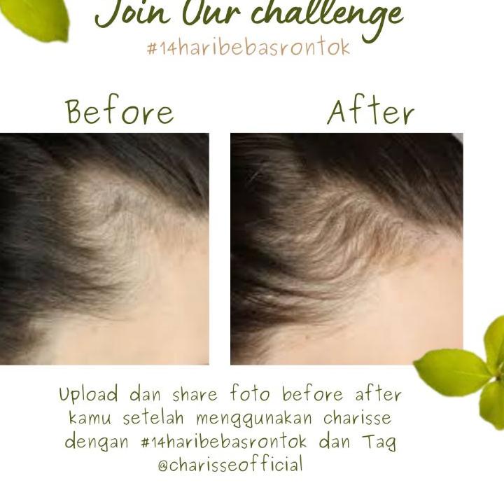 Baru - HAIR OIL GINSENG  HAIR OIL | HAIR SERUM | HAIR SERUM GINSENG | ARGAN OIL | GINSENG OIL | CAST