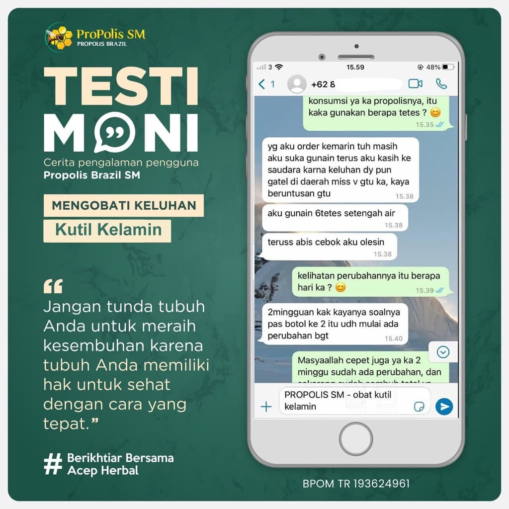 Obat Herbal Daging Jadi, Kutil Kelamin, Papiloma, Keloid, Milia, Ganglion, Skin Tag, Parasit, Mata Ikan, Kelenjar Getah Bening, Jerawat Bopeng, Benjolan di Tubuh, Kapalan, Uci uci, Fibroid - PROPOLIS SM BRAZILIAN 100% ORIGINAL BPOM
