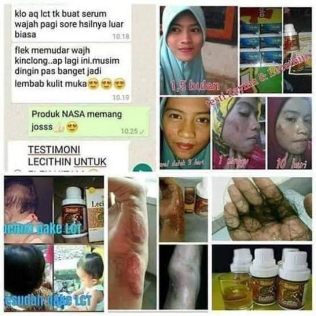 LECITH NASA OBAT SAPU JAGAT JERBAL