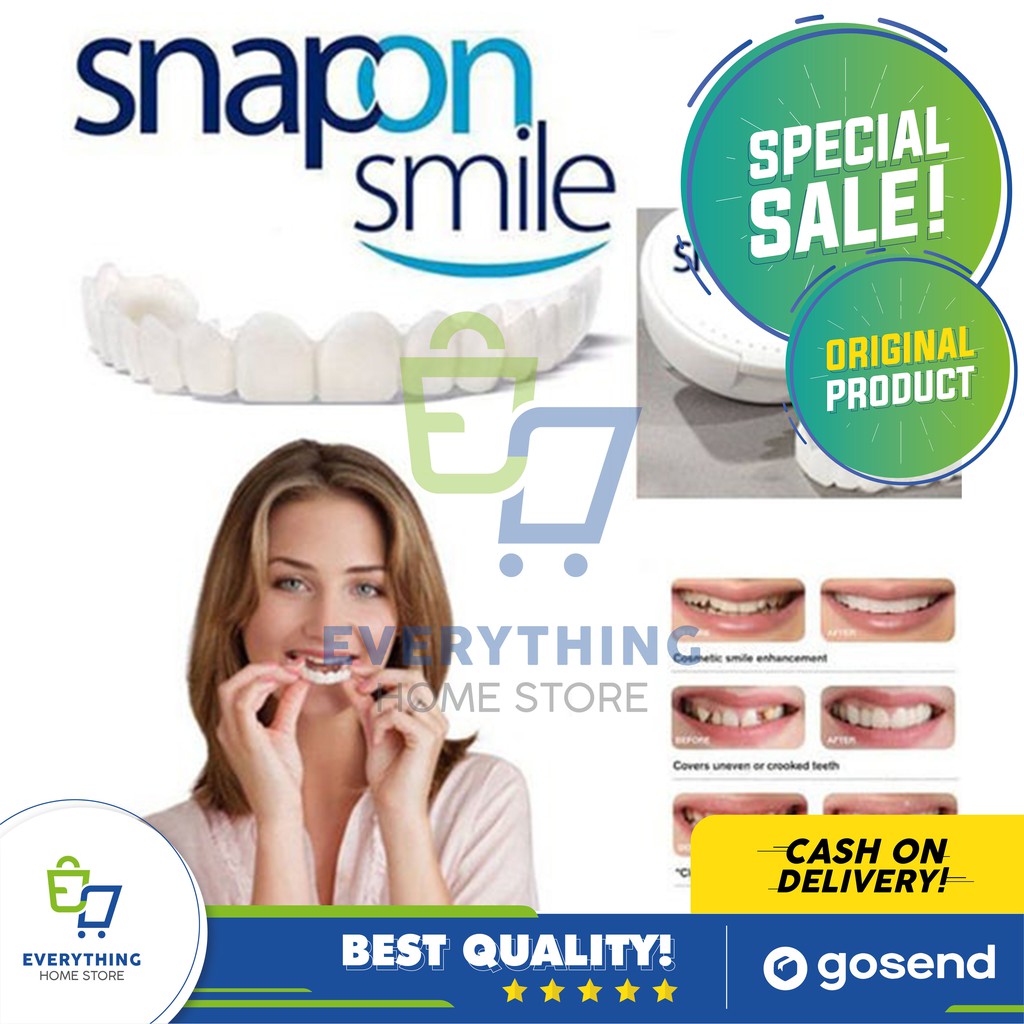 Snap On Smile 100% ORIGINAL Authentic | Snap 'n Smile Gigi ...