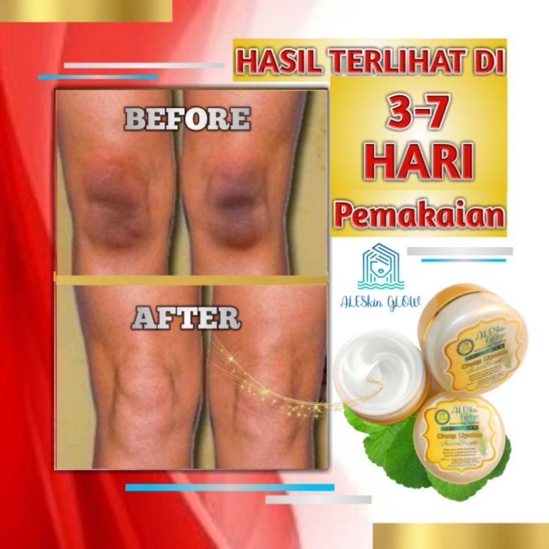 PAKET HEMAT PEMUTIH KETIAK CREAM MASKER dan Selangkangan Ampuh Bokong Pantat Siku Wajah Lutut Hitam