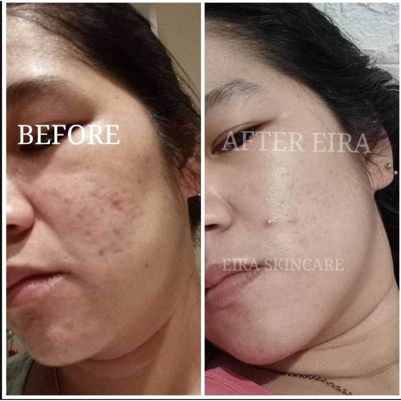 EIRA SKINCARE