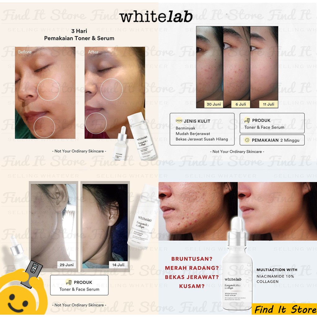 Whitelab Brightening Facial Wash | Toner | Face Body Serum | Day Night Cream | Underarm Cream | Acne | pH-Balanced Facial Cleanser