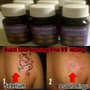 Obat Penghapus Tatto Permanen Asli Obat Cair Penghilang Tato Obat Tattonox Original