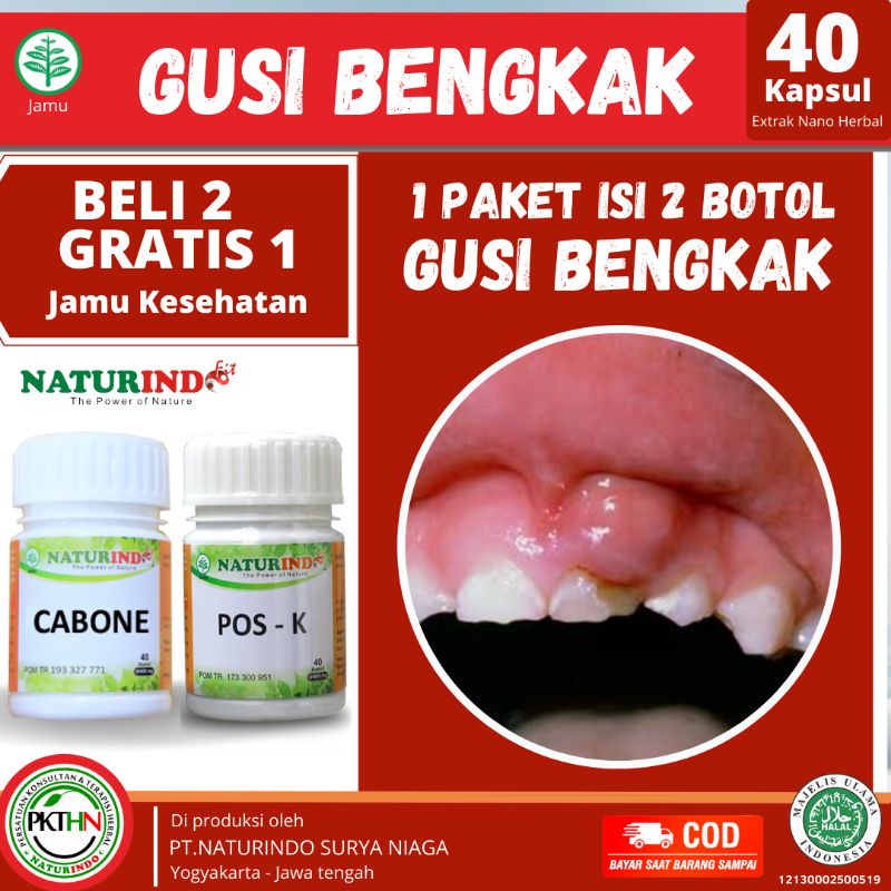 Obat penguat gigi sakit gigi berdarah gigi goyang gigi ompong gusi bengkak gigi dewasa dan anak penguat gigi goyang tua berlubang nutrisi dan kalsium gigi sakit gigi gigi keropos