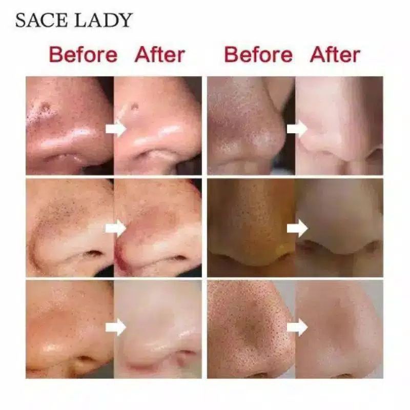 MASKER KOMEDO SACE LADY || PORE PACK NOSE PACK DEEP CLEANSING PORE STRIPS