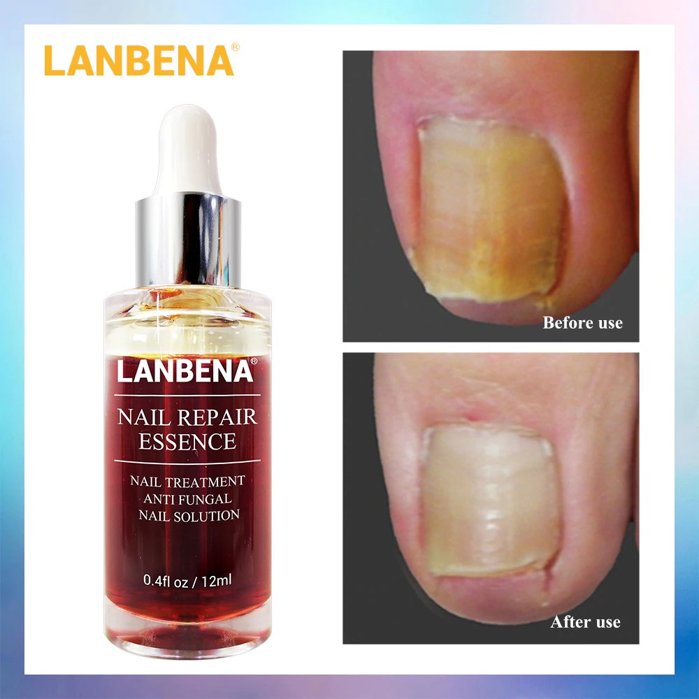 lanbena nail repair