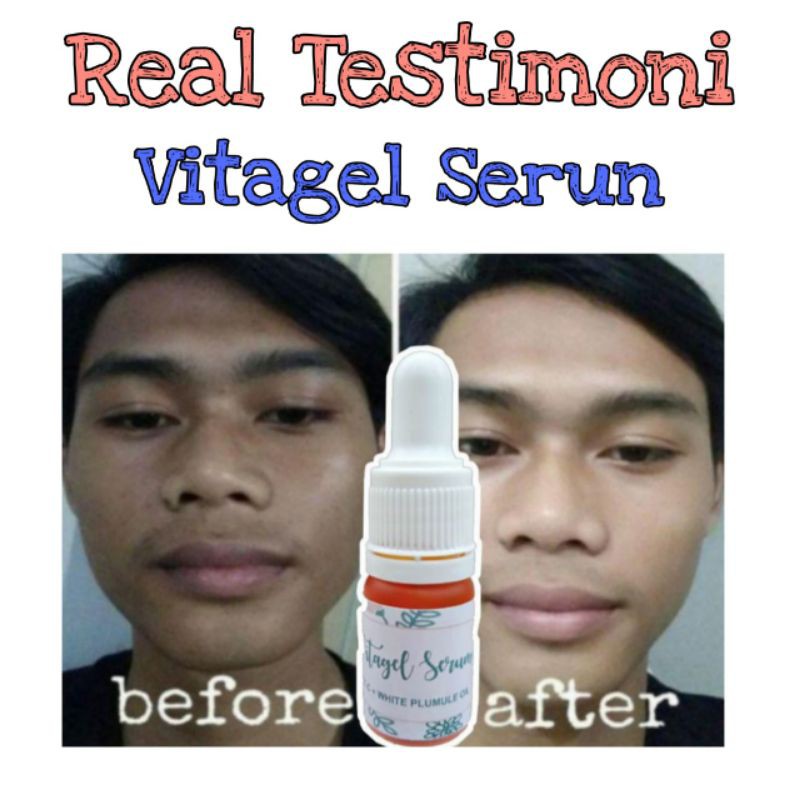 TERLARIS | Vitagel Serum | Boster Angkat Flek Hitam