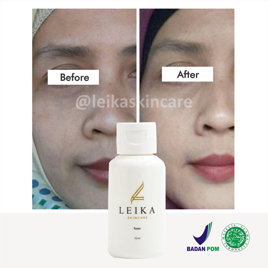 Toner Pelembab Kulit Wajah Kering / Berminyak Pelembab Wajah Cepat Bikin Putih Mencerahkan dan Glowing Ampuh Toner Leika Skincare Halal MUI Resmi BPOM