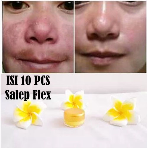 PROMO  SALEP FLEK HITAM 10 PCS - SALEP FLEK MELASMA ORIGINAL